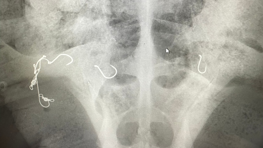 An x-ray image of a turtle's skeleton showing seven small fishing hooks illuminated