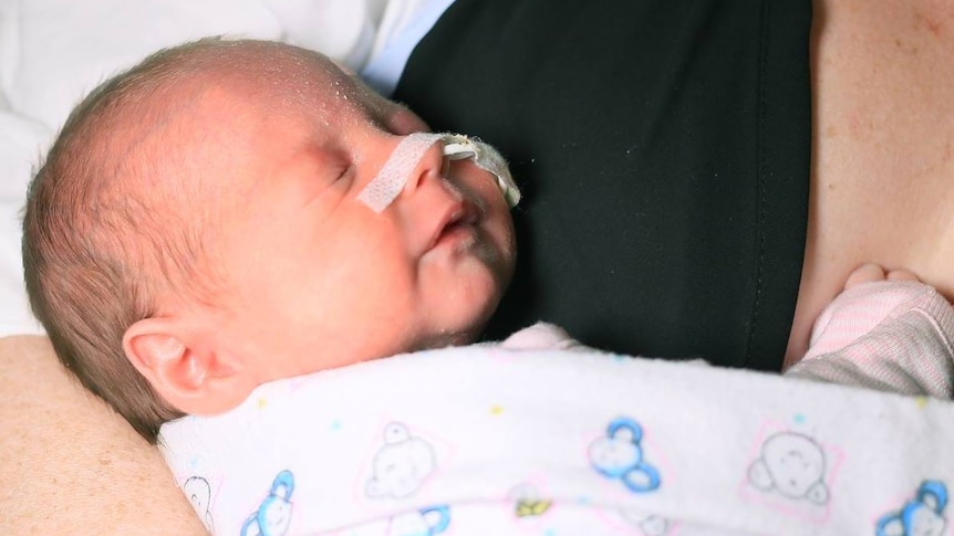 A premature baby with a tube in its nose get a cuddle from its mother.