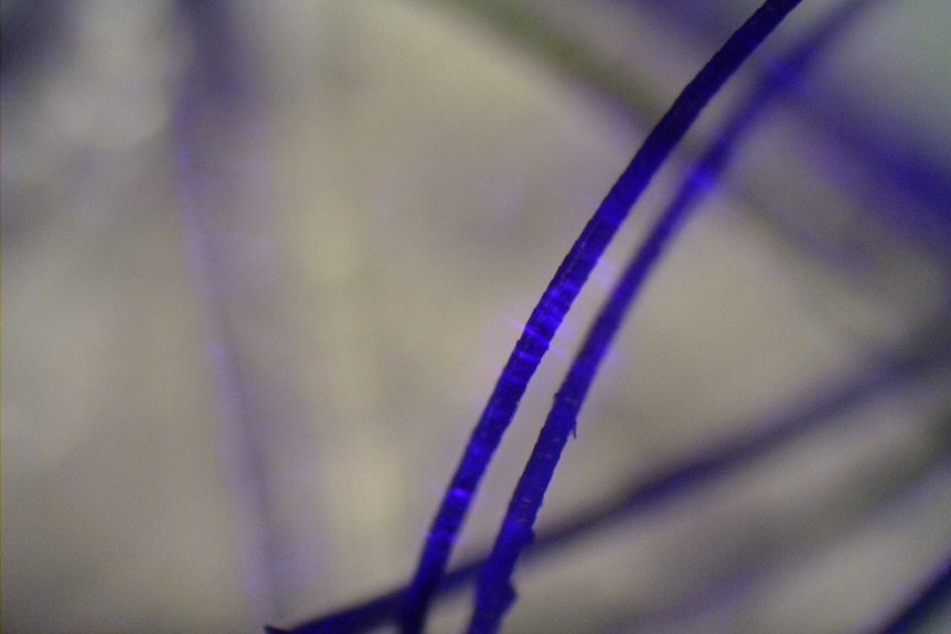 A microscopic image of hairs glowing bright blue. There are two hairs in focus.