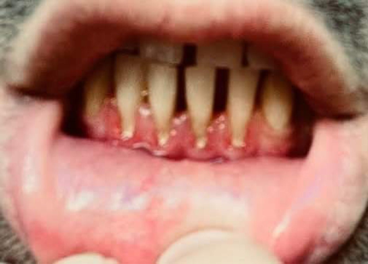 A close picture of a mouth shows thin teeth and receeding gums.