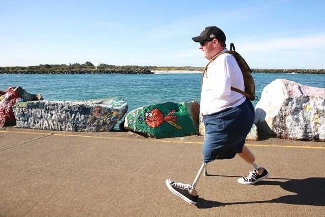 A man with prosthetic legs, wearing shorts and a backpack, walks last a body of water