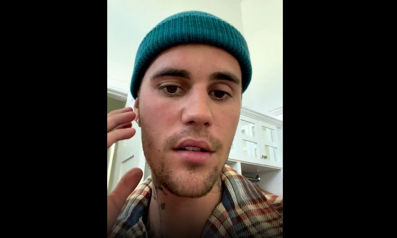 Justin Bieber Says He Has Facial Paralysis From Ramsay Hunt Syndrome ...