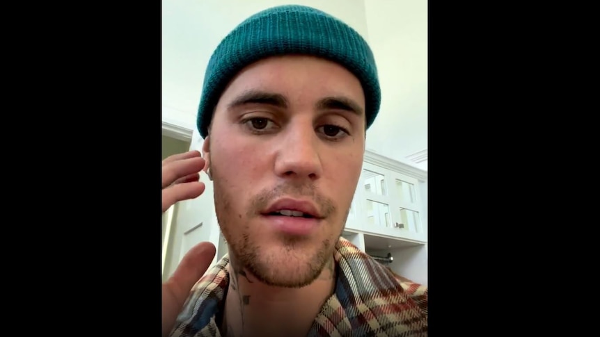 Justin Bieber points to the right side of his face, which is paralysed.