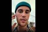 Justin Bieber points to the right side of his face, which is paralysed.