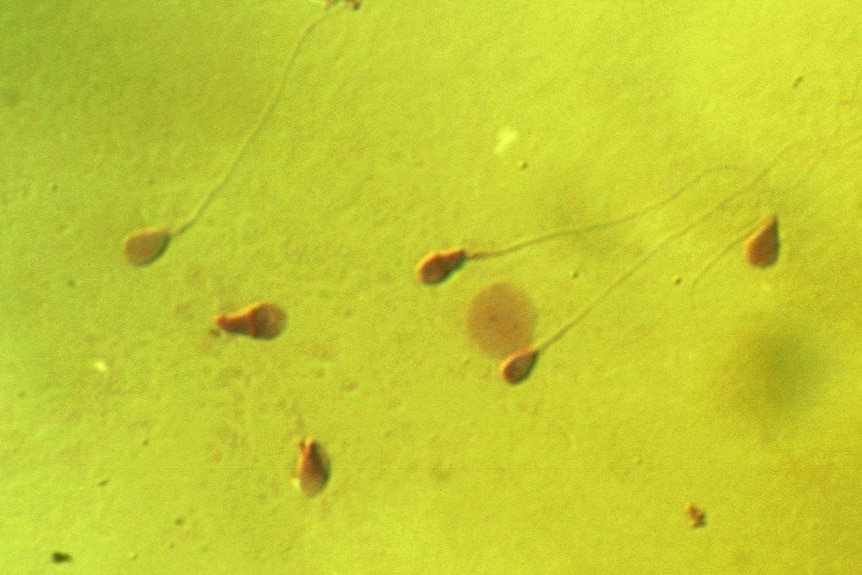 Human sperm seen through a microscope.