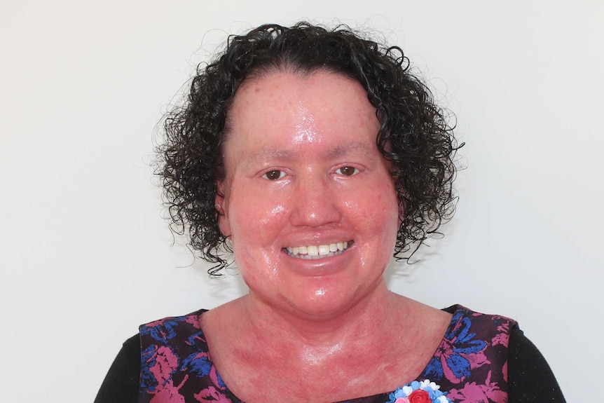 Carly Findlay wears a black, pink and blue shirt with a floral brooch.