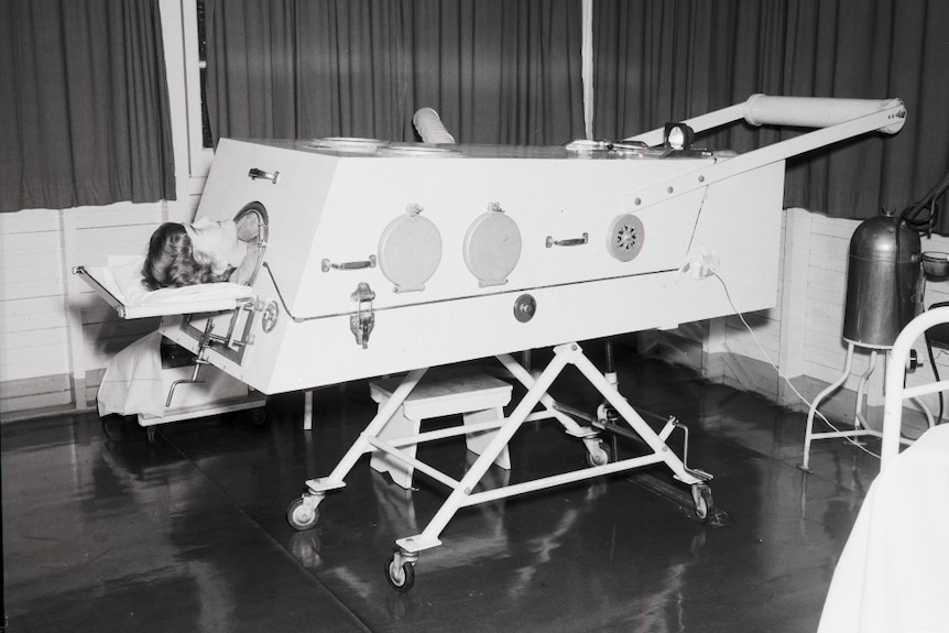 A polio patient lies encased in an iron long.