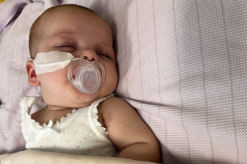 A baby in a hospital bed with a feeding tube in her nose.