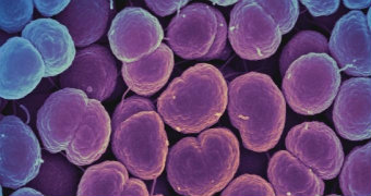Purple and blue scan of Neisseria gonorrhoea bacteria.