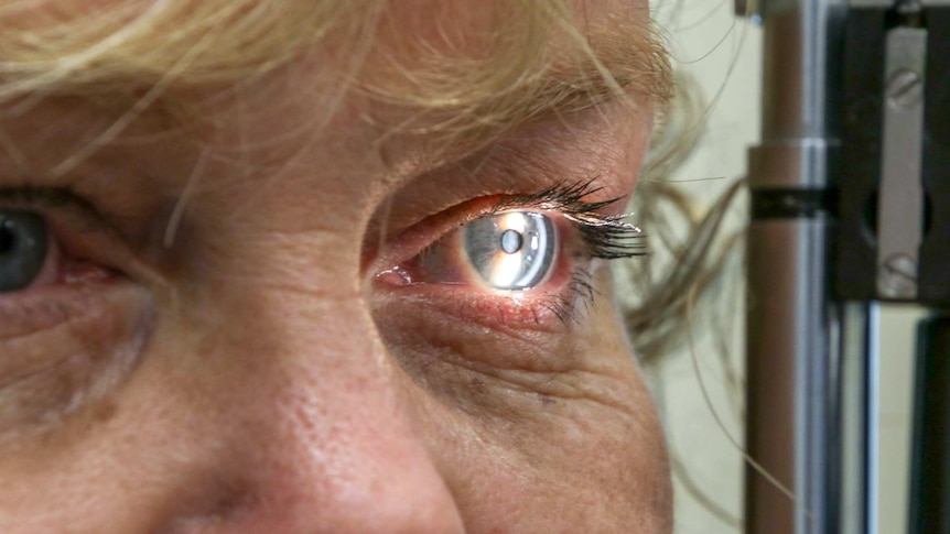 Close up of a woman getting the Alzheimer eye test.