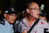 Police assist a bloodied pro-democracy protestor in Hong Kong