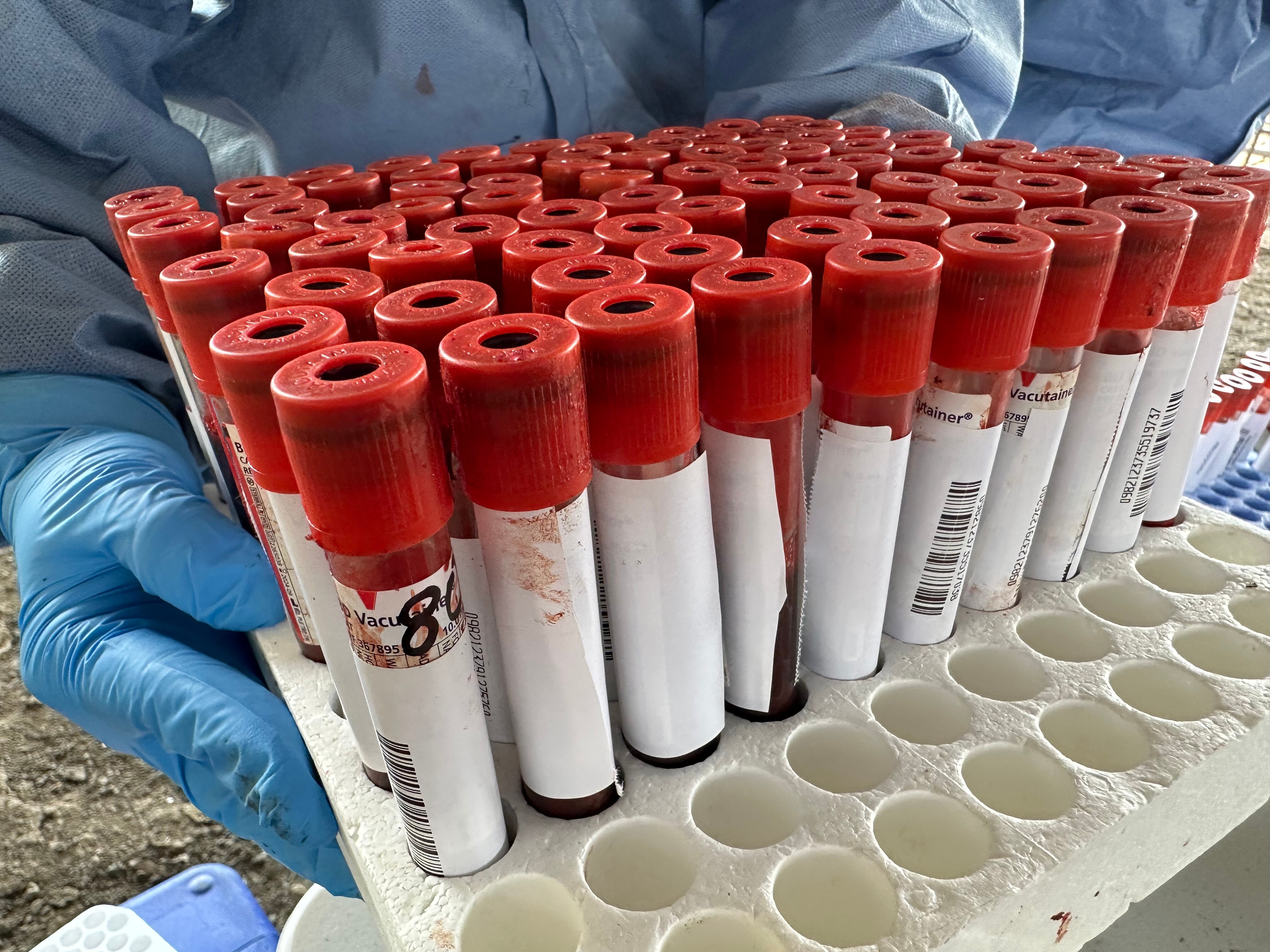 collection of blood samples in vials
