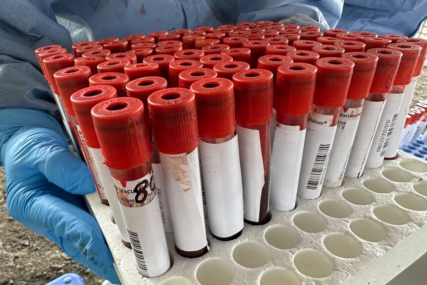 collection of blood samples in vials