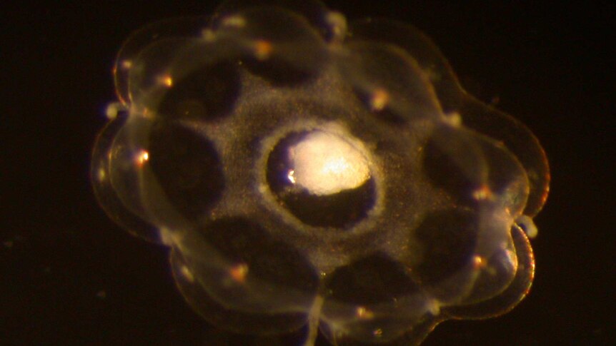 A microscopic jellyfish under a microscope