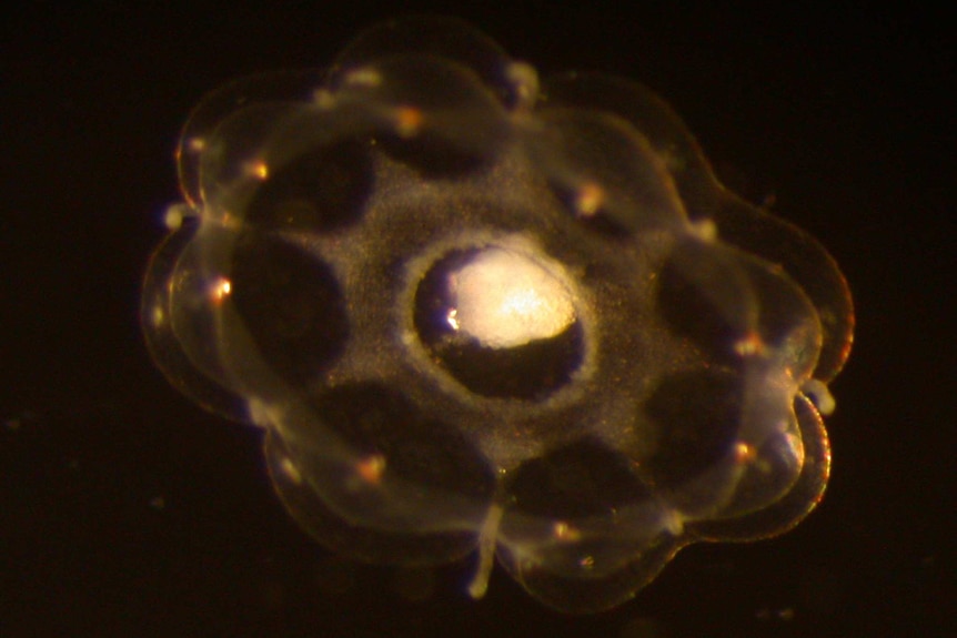 A microscopic jellyfish under a microscope