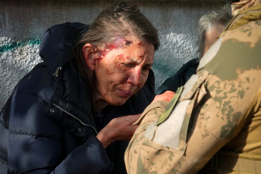 An older woman holds her hand in front of her face as she sits bleeding, and is attended to by two people.