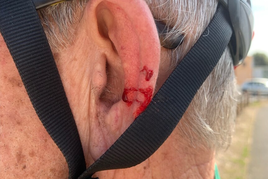 A bleeding ear