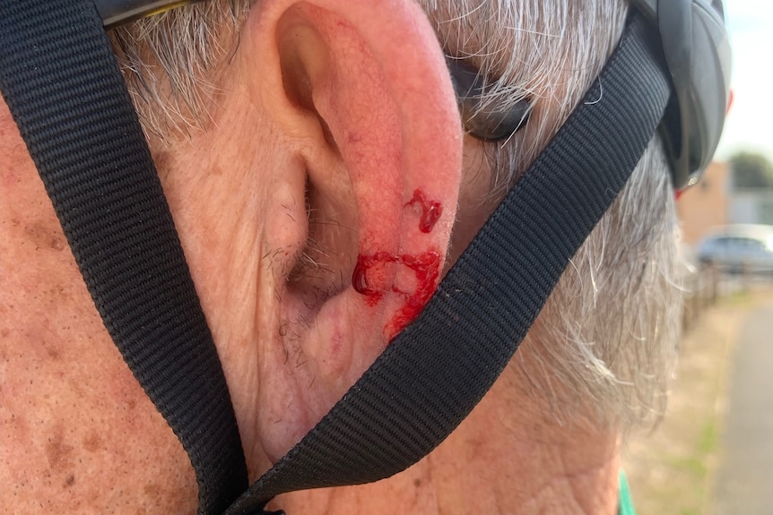 A bleeding ear