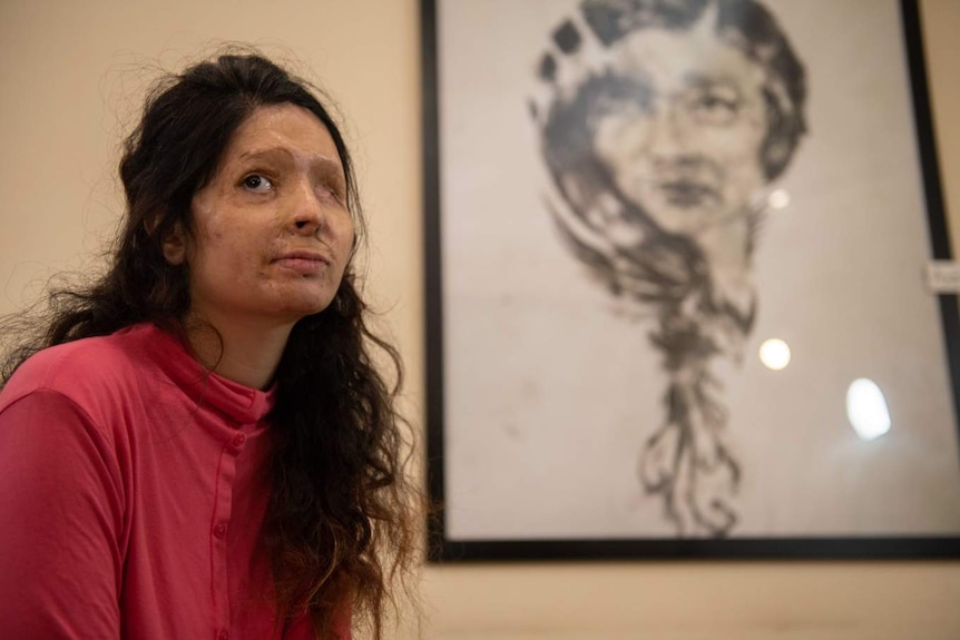 A woman with a scarred face sits in front of a painting of a woman looking pensive.