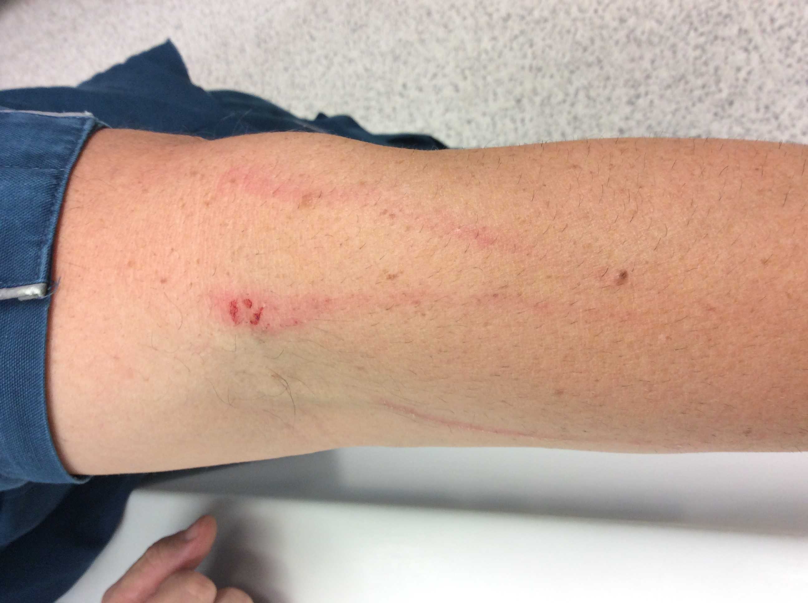Gold Coast paramedics threatened with syringe, kicked, spat on in ...