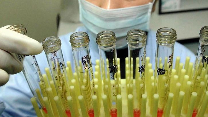 Test tubes containing stem cells