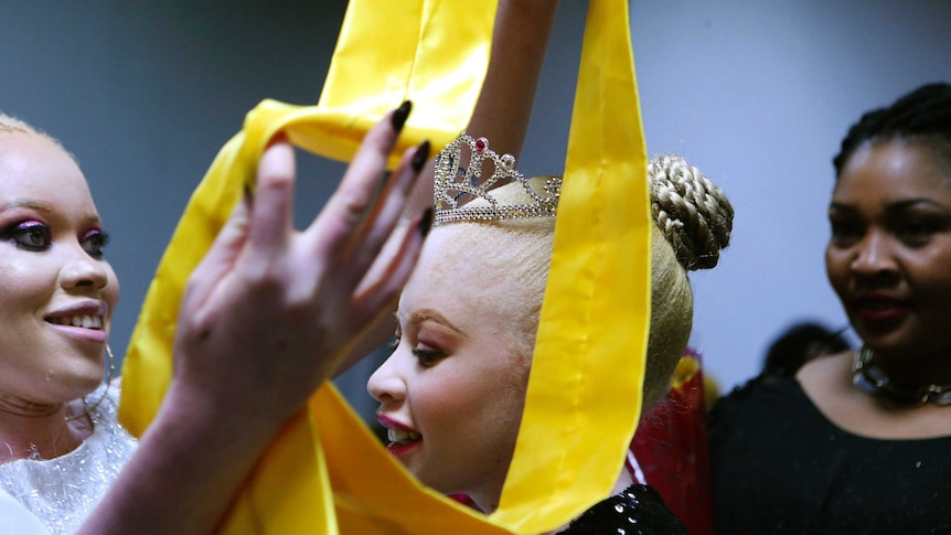 A woman with albinism is crowned with a plastic tiara and a bright yellow sash in a dimly-lit room.