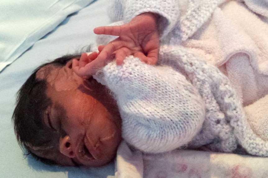 An unwell newborn girl lies in a hospital cot wearing a light pink woollen jumper.