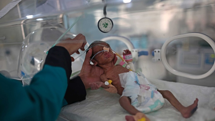 A medic checks a malnourished newborn baby inside an incubator