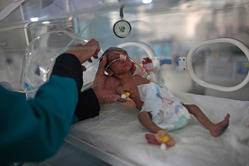 A medic checks a malnourished newborn baby inside an incubator