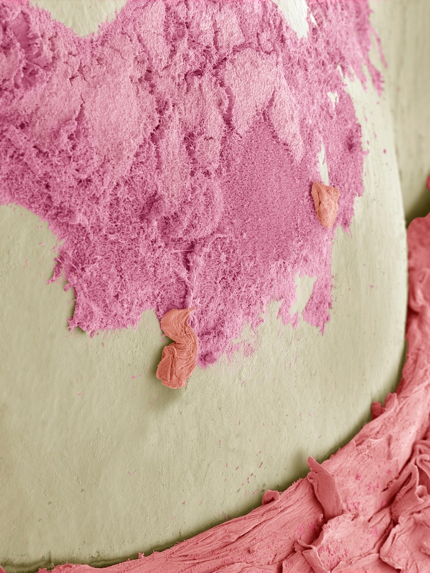  A pink film of bacteria growing on a tooth