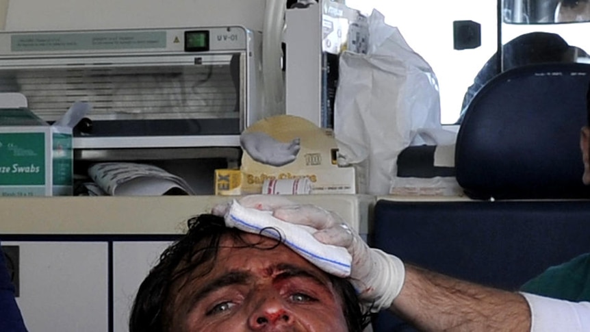 A wounded Libyan rebel points to the camera as he is treated near Ajdabiya on March 25, 2011.
