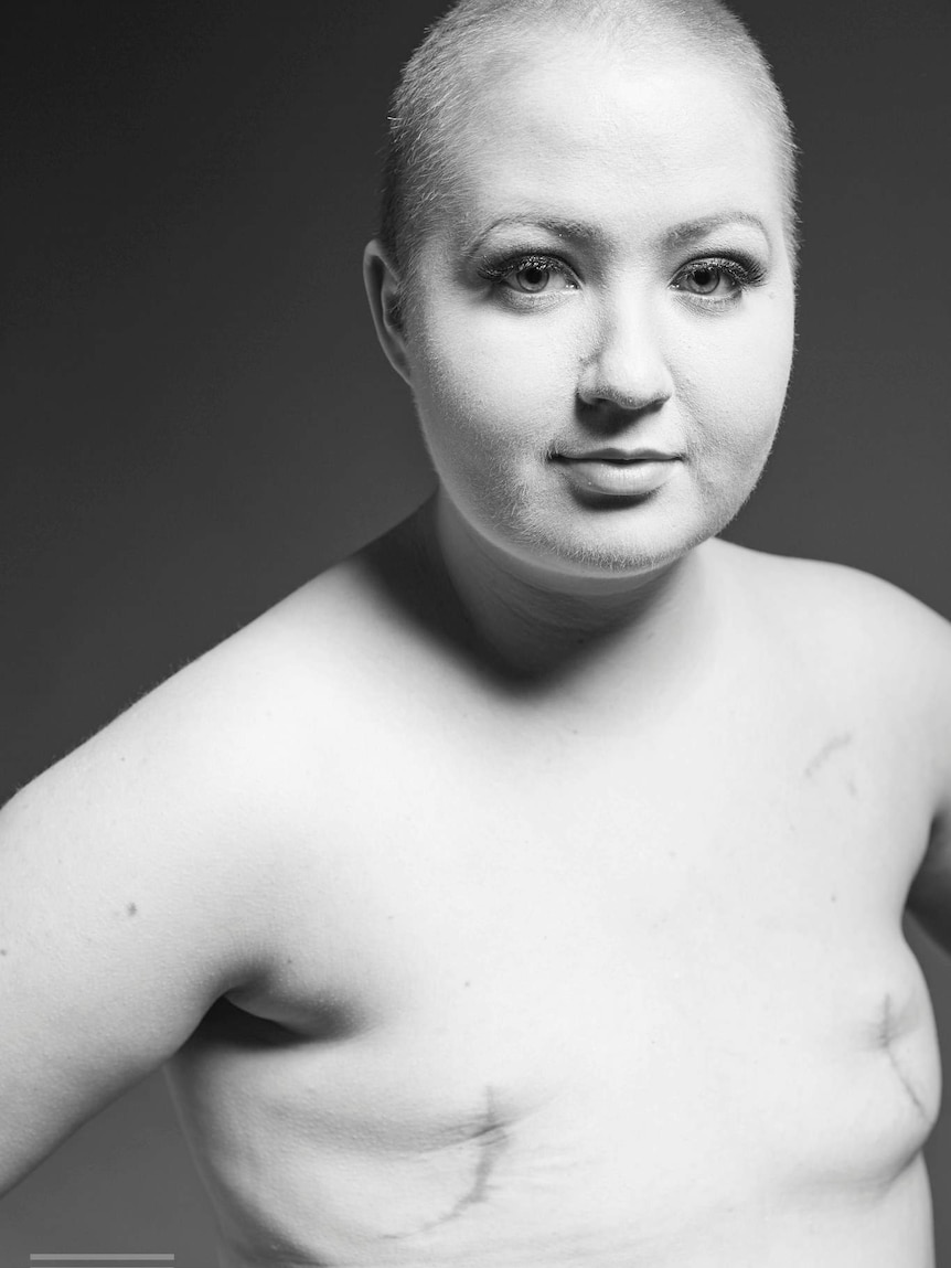 One of the images from Allison Snare's photo shoot after her double mastectomy