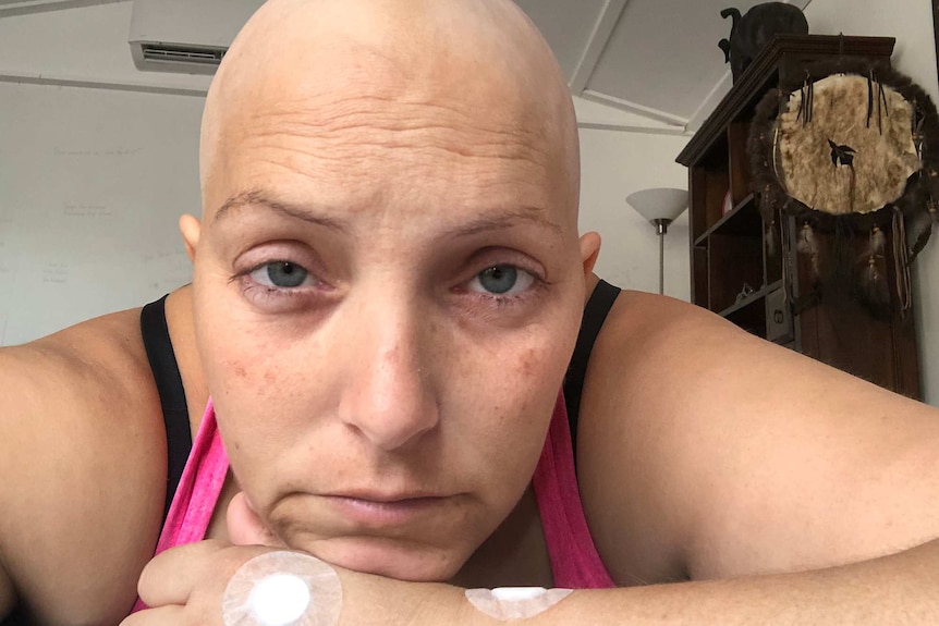 A close-up shot of the face of a woman who is bald and undergoing treatment for cancer.