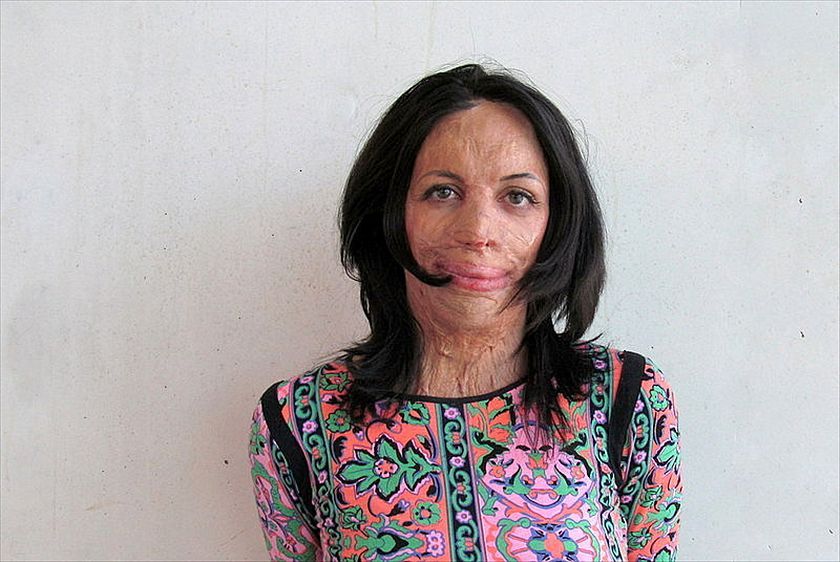 Turia Pitt is a survivor episode artwork