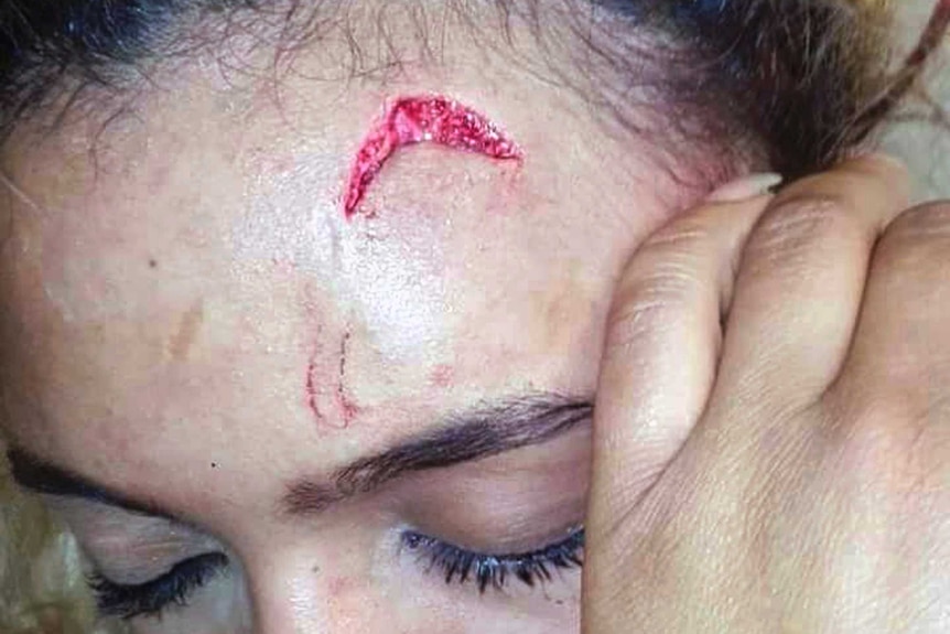 A closeup photo shows a gash on the forehead of Debbie Engels.