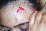 A closeup photo shows a gash on the forehead of Debbie Engels.