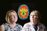 Karen Cooke and Linda Jackson with a picture of a brain affected by dementia.