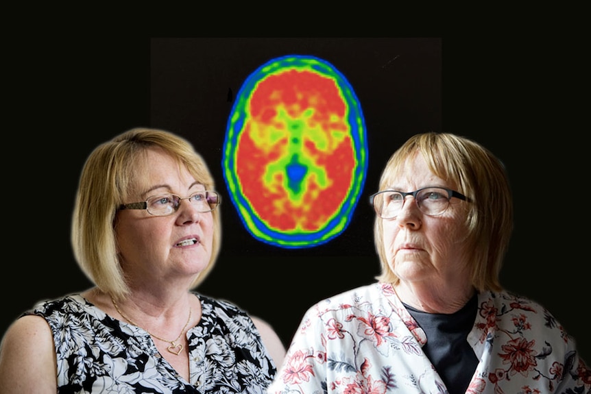 Karen Cooke and Linda Jackson with a picture of a brain affected by dementia.