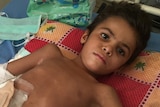 An 8-year-old boy lies on a bed with heavy bandages covering his abdomen.