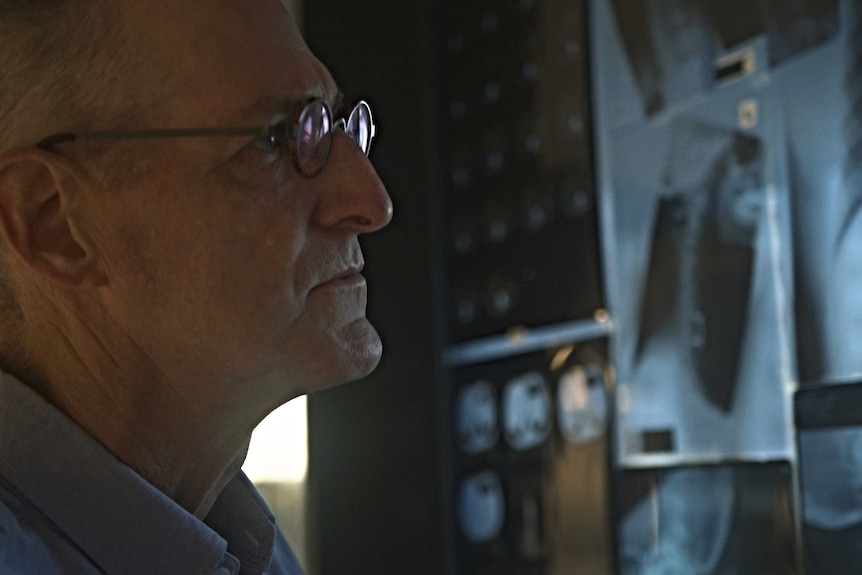 A man stands looking at a number of X-rays in front of him.