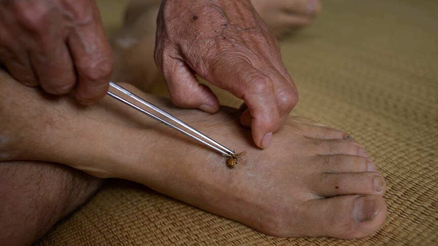 A traditional Chinese medicine doctor administers a bee sting to a patient