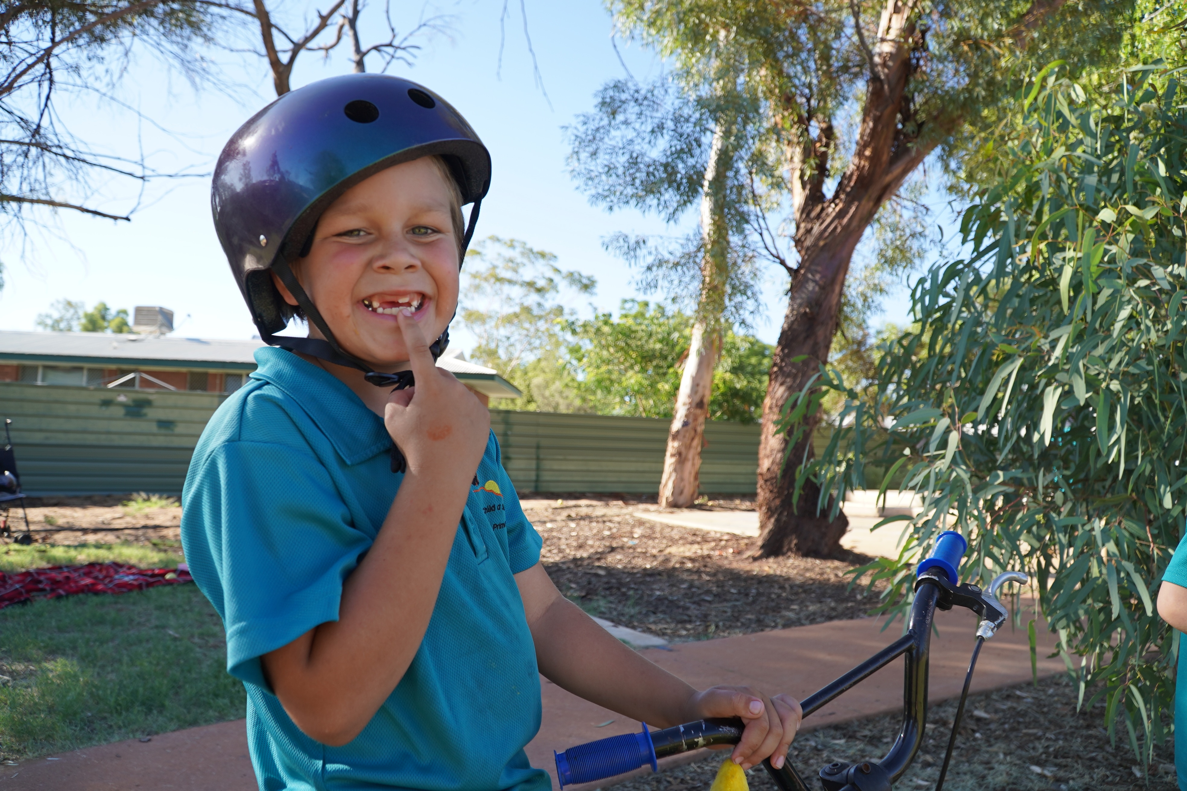 Un niño con casco de bicicleta sonríe a la cámara y señala el hueco donde se le cayeron los dientes de leche.