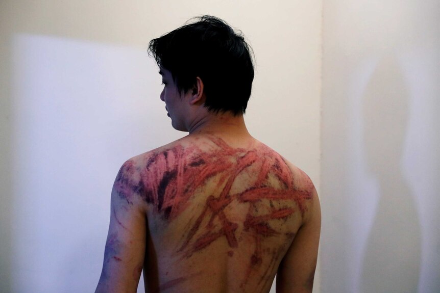A man with bloody marks on his back.
