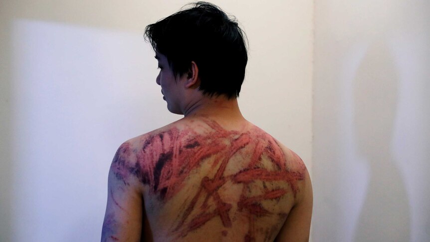 A man with bloody marks on his back.