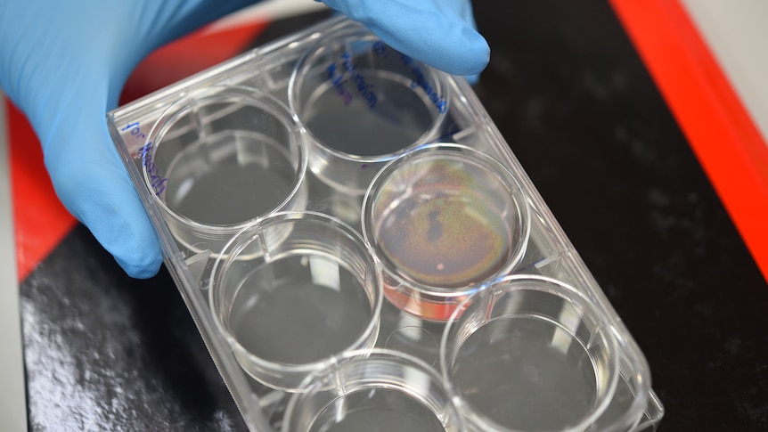 Cells in a petri dish