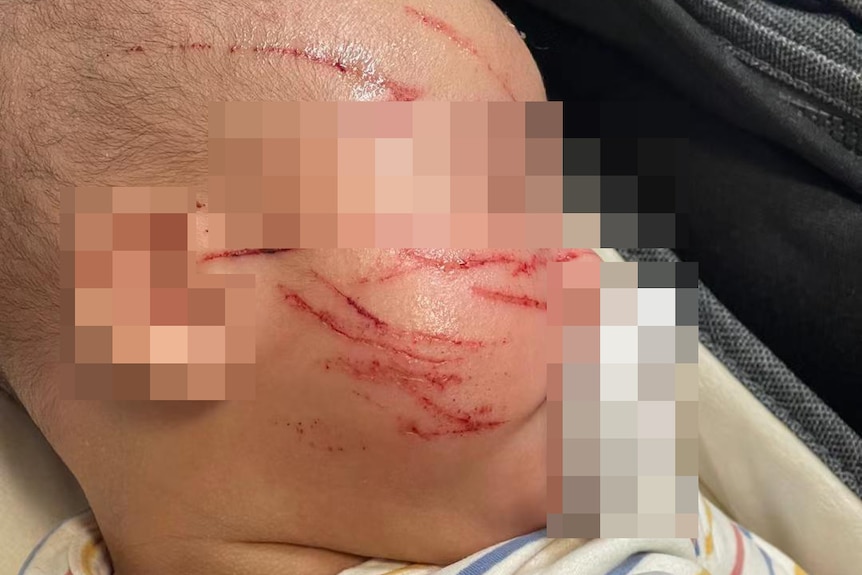 A anonymised picture of a baby with scratches on its face. 
