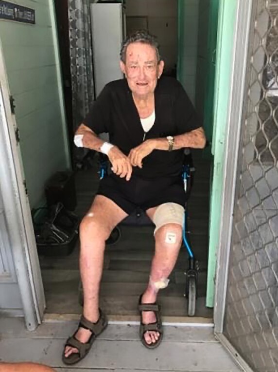 An elderly man with cuts on his legs and arms sitting on a wheelie walker at his front door