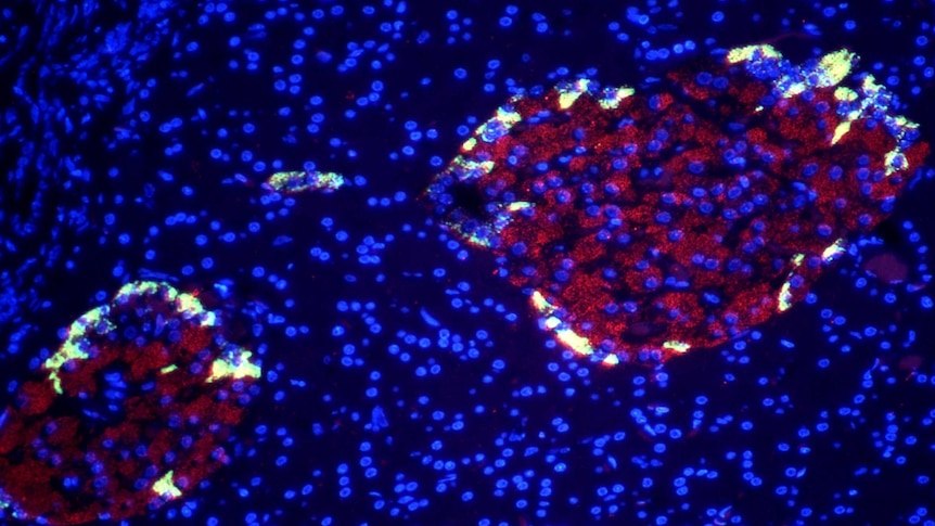 Fluoroscent light micrograph of cells in an islet lf Langerhans in the pancreas.