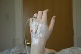 A woman's hand with a drip attached