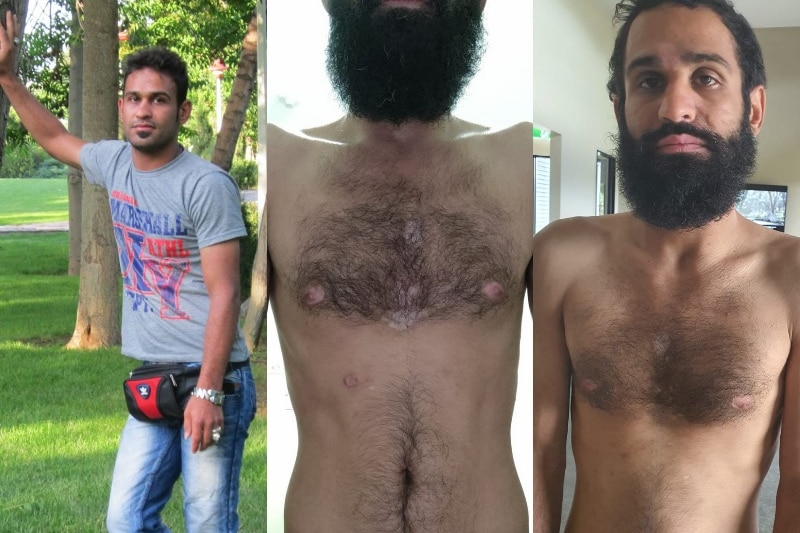 Three images of Ahwazi refugee from Iran ​​​​​​​Amin Afravi showing his weight loss from 72 kilograms to 48 kilograms.